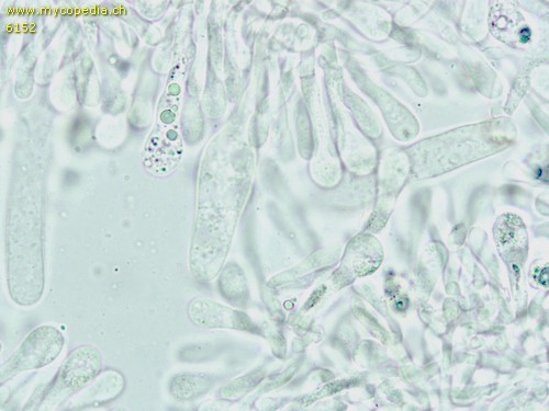 Cyclocybe erebia - Cheilozystiden - 