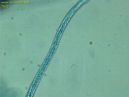 Ophiocordyceps sinensis - Asci - 
