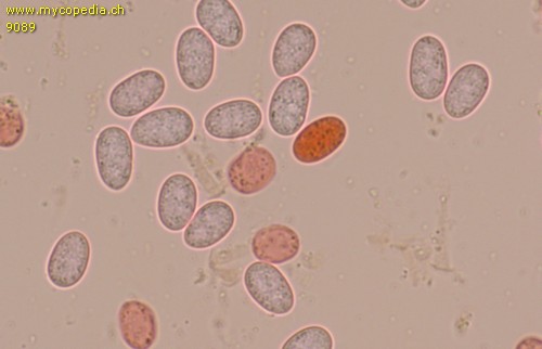 Ceratiomyxa fruticulosa - Sporen - 